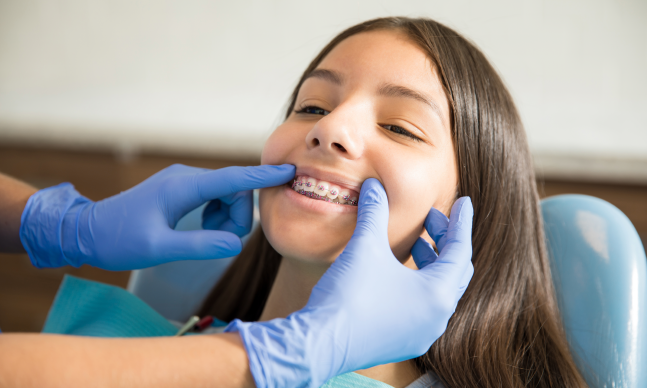 Ortodontia:o que é e porque é tão importante