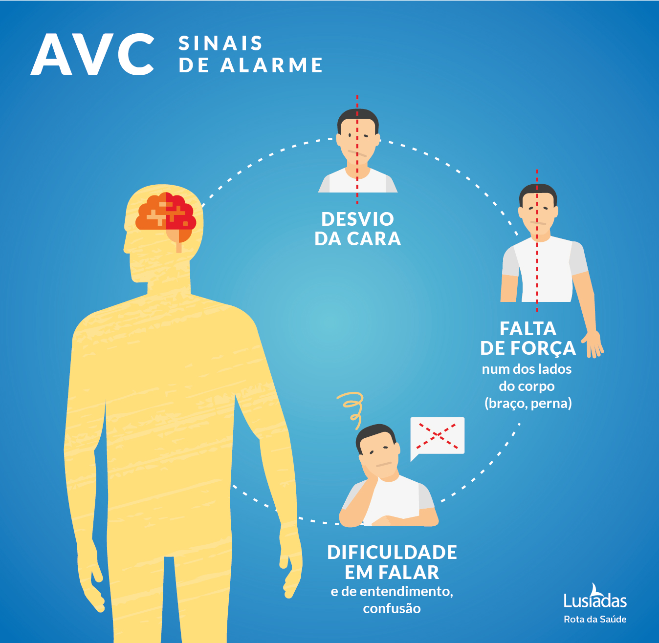 AVC: reconhecer os sinais de alarme e sintomas