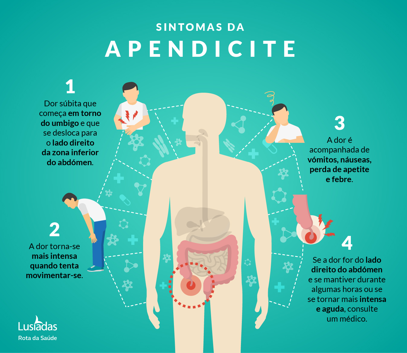 Quais os sintomas de apendicite?