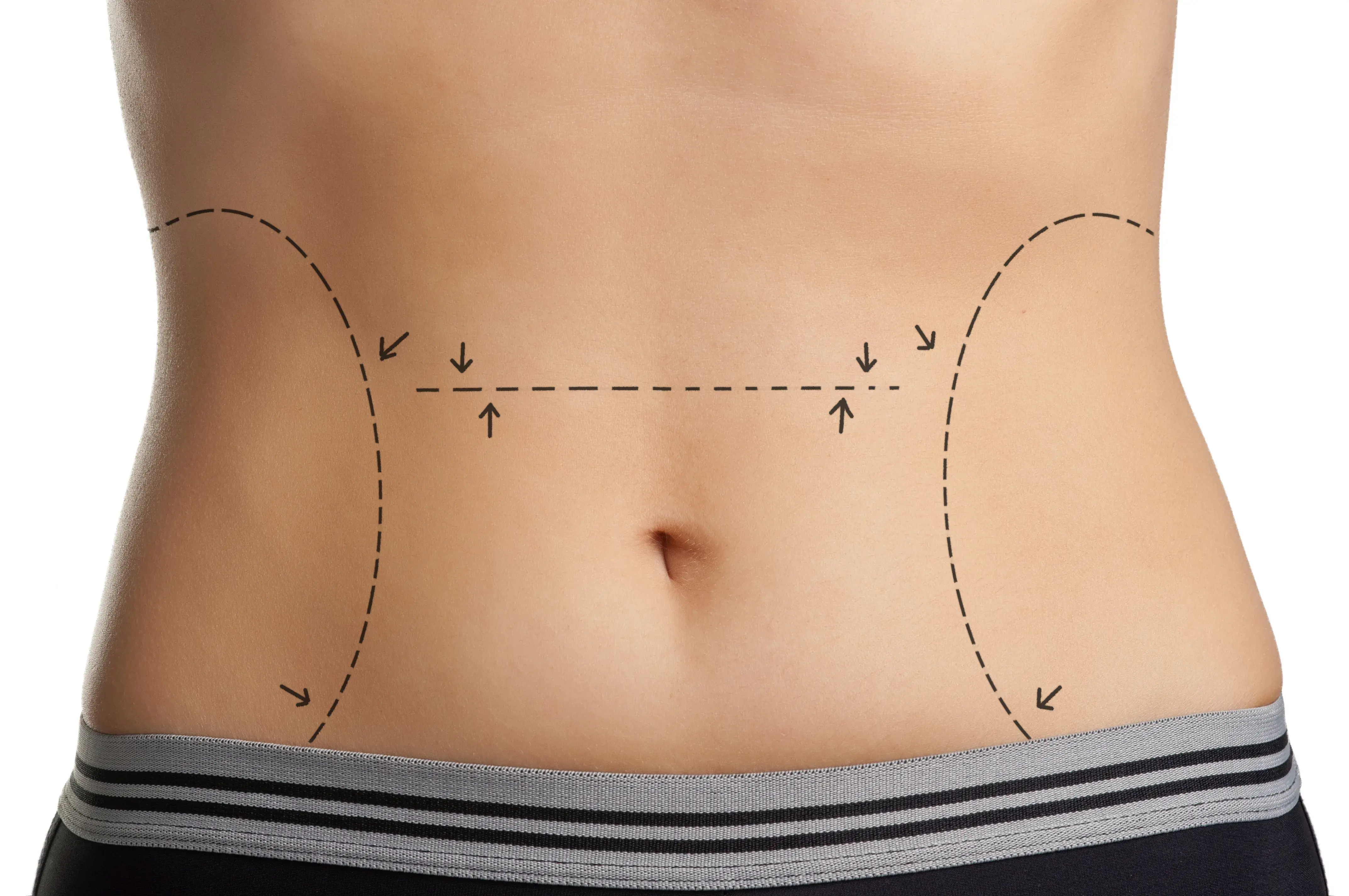 Cirurgias plásticas: quais são as mais pedidas?