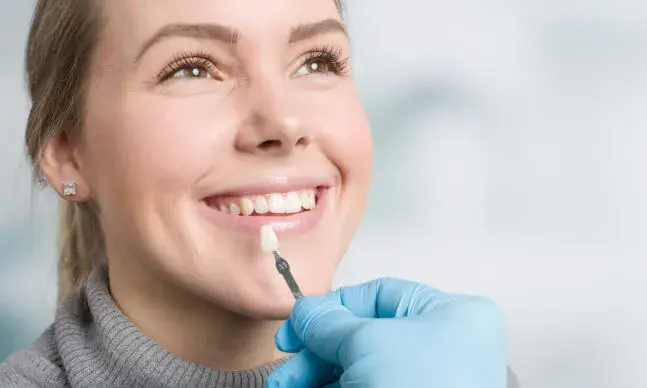 facetas dentarias