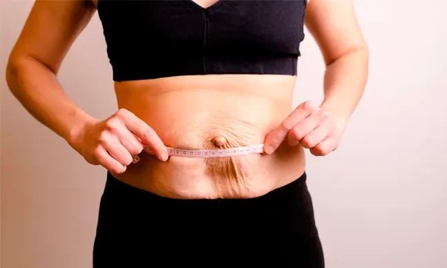 diastase abdominal 