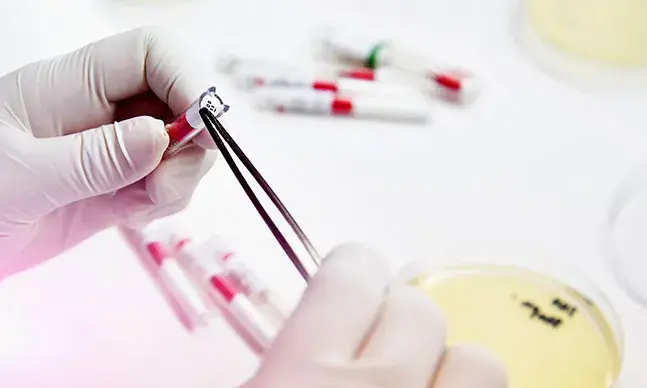 Sépsis: o que é e como se trata