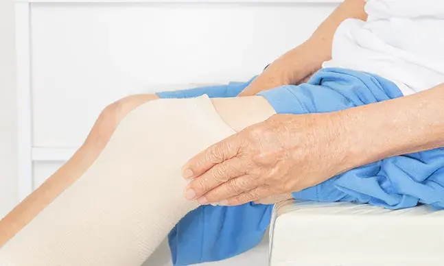 Úlcera de perna: como tratar de uma úlcera venosa de perna