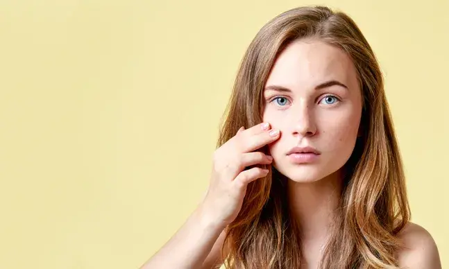 Acne na adolescência: o que deve saber