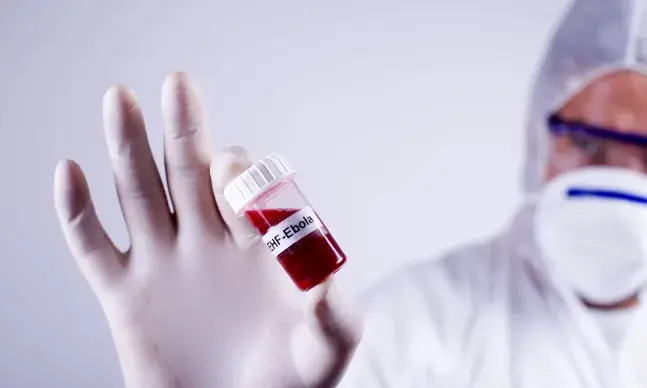 O vírus do Ébola transmite-se através do contacto direto com o sangue ou outros fluidos corporais de pessoas ou animais infetados.