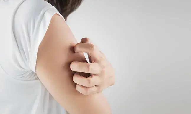 Tudo o que deve saber sobre eczema