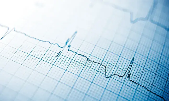 Saiba o que é o eletrocardiograma, para que serve e como é feito