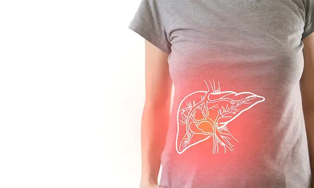 Fígado gordo: o que é a esteatose hepática?