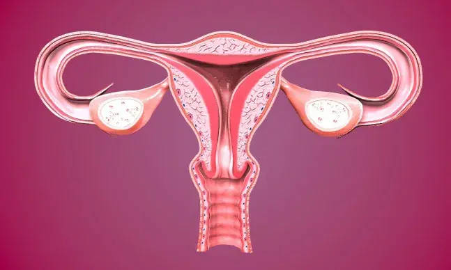 Histerossalpingografia: o que é e como se faz