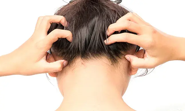 Facto ou mito: pintar o cabelo mata os piolhos e lêndeas?