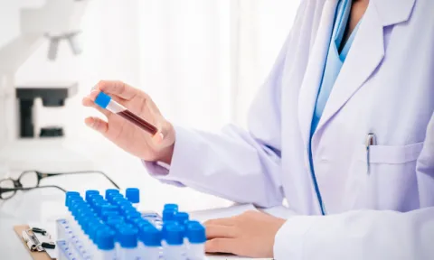 Doação de sangue: dúvidas frequentes Doação de sangue: dúvidas frequentes