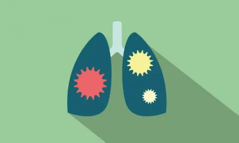A fibrose quística é uma doença genética associada a problemas pulmonares e nutricionais. Consiste numa disfunção das glândulas exócrinas que produzem secreções anómalas (muco mais espesso) A fibrose quística é uma doença genética associada a problemas pulmonares e nutricionais. Consiste numa disfunção das glândulas exócrinas que produzem secreções anómalas (muco mais espesso)