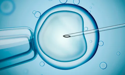 FIV e inseminação arteficial: os diferentes tipos FIV e inseminação arteficial: os diferentes tipos