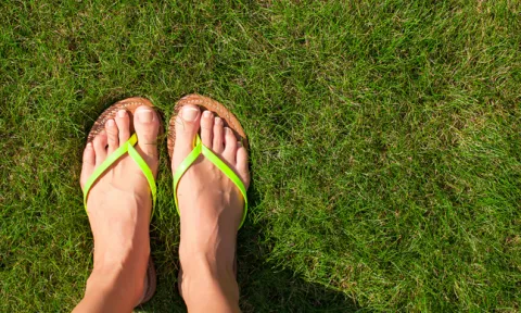 A micose das unhas também designada por onicomicose é uma doença infeciosa causada por fungos. A micose das unhas também designada por onicomicose é uma doença infeciosa causada por fungos.