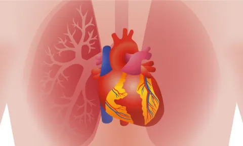 Prova de esforço cardiopulmonar: o que é?