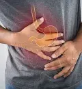 Doença de Crohn: sintomas e tratamento