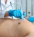 ecocardiograma