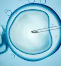 FIV e inseminação arteficial: os diferentes tipos