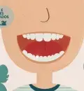 Os dentes de leite também podem ter cáries e pôr em risco a saúde oral na idade adulta.