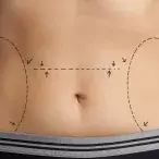 Cirurgias plásticas: quais são as mais pedidas?