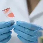 Imunoterapia: o que é e como funciona?