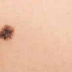dermatologia