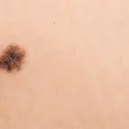 Dermatologia