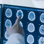 neurologia