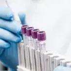 analises clinicas