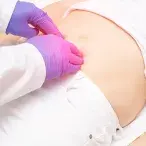 Hernia inguinal