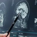 Neurosurgery