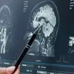 neurocirurgia