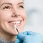 facetas dentarias