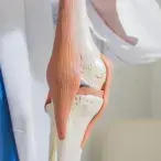 Unidade de Artroplastias