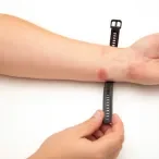 dermatite contato