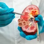 cirurgia renal