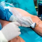 angiologia