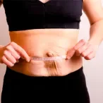 diastase abdominal 
