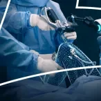 Grupo Lusíadas Saúde inicia cirurgia robótica do joelho no Hospital Lusíadas Amadora com o Sistema VELYS™