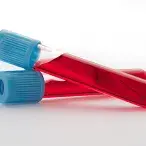 Chama-se anemia à redução do número de glóbulos vermelhos no sangue
