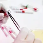 Sépsis: o que é e como se trata