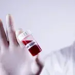 O vírus do Ébola transmite-se através do contacto direto com o sangue ou outros fluidos corporais de pessoas ou animais infetados.