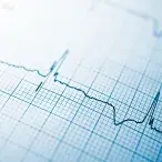 Saiba o que é o eletrocardiograma, para que serve e como é feito