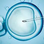 FIV e inseminação arteficial: os diferentes tipos