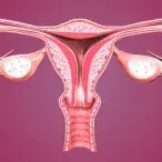 Histerossalpingografia: o que é e como se faz