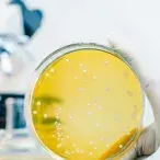 A Legionella pneumophila é uma bactéria que está presente na água e na terra, mas é quando se aloja nos nossos pulmões que se pode tornar mortal.