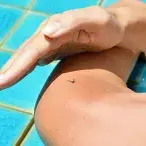 Os mosquitos só picam algumas pessoas?