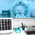 TAC: esclareça as suas dúvidas sobre este exame