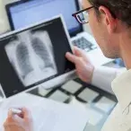 A tuberculose é uma doença infetocontagiosa, curável, causada por uma micobactéria (mycobacterium tuberculosis), cuja transmissão ocorre por via inalatória.